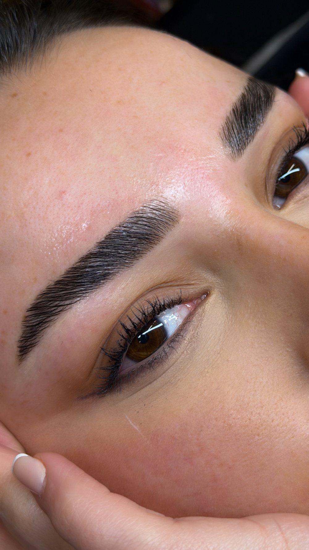Augenbraue nach dem Brow Lifting